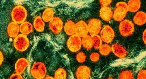 ‘एमपक्स’का कारण अफ्रिकामा दुई हजार जनाको मृत्यु